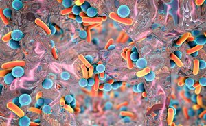 Microscopic view of a biofilm with bacteria embedded in extracellular matrix
