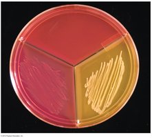 Selective media plate with Staphylococcus species