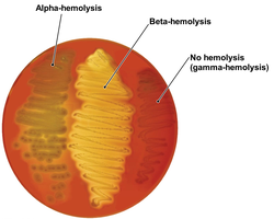 Blood agar showing differential hemolysis