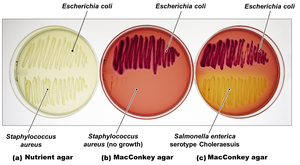 MacConkey agar showing selective and differential growth