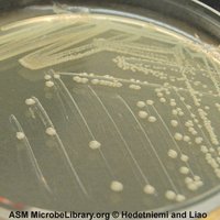 Isolated colonies on an agar plate