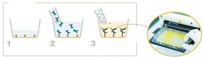 Agglutination reaction in blood typing
