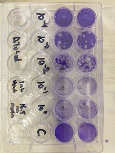 PRNT result plates