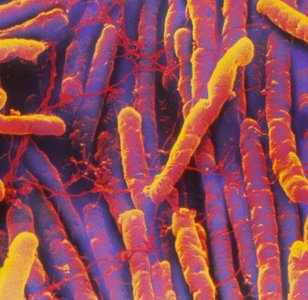 Electron micrograph of Clostridium difficile