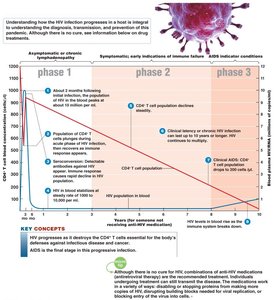 Graph of HIV infection progression and CD4+ T cell count