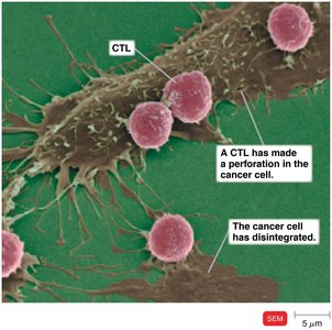Cytotoxic T lymphocyte attacking a cancer cell