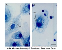 Mycobacterium tuberculosis in macrophages