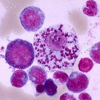 Macrophage with Leishmania