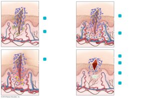 Steps of the acute inflammatory response