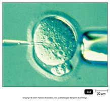 Microinjection of DNA into a cell