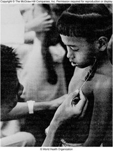 Skin lesion in leprosy