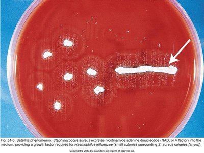 Satellite phenomenon of Haemophilus influenzae
