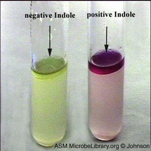 Indole test for Haemophilus influenzae