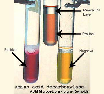 Ornithine decarboxylase test for Haemophilus influenzae