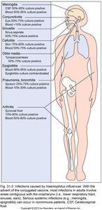 Haemophilus influenzae infections by body site