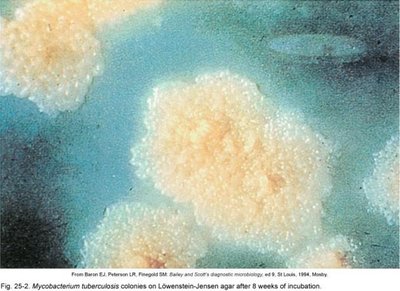 Mycobacterium tuberculosis colonies on Lowenstein-Jensen agar