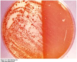 UV Radiation—Serratia marcescens