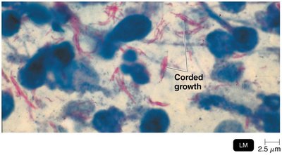 Acid-fast cell wall: Mycobacterium tuberculosis