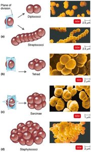 Arrangements of cocci: diplococci, streptococci, tetrad, sarcinae, staphylococci