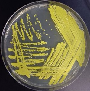 Streaking for isolation