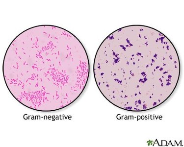 Gram stain comparison
