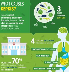 Infographic on causes of sepsis and common bacteria
