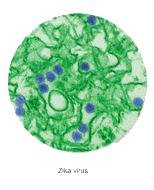 Microscopic image of Zika virus