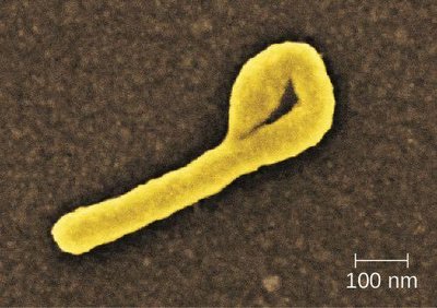Electron micrograph of Ebola virus particle