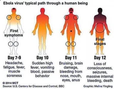 Progression of Ebola virus symptoms