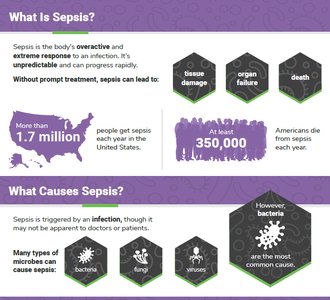 Infographic explaining sepsis, its causes, and outcomes