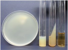 Types of growth media: broth, agar slant, agar deep, agar plate