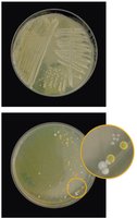 Mixed culture showing different colonies