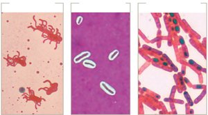Comparison of structural stains: flagella, capsule, endospore