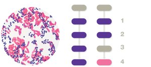 Gram stain procedure and results