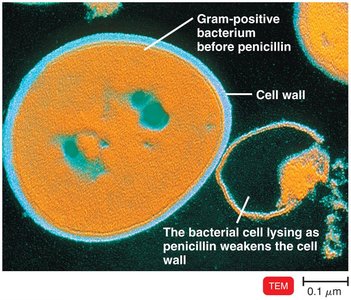 Penicillin action on bacterial cell wall