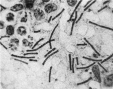 Photomicrograph of anthrax bacillus