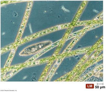 Microscopic view of algae and protozoa