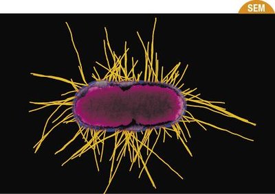 Fimbriae on a bacterial cell