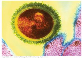 Bacterial capsule