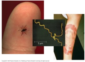 Borrelia burgdorferi and Lyme disease transmission