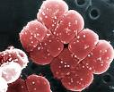 Deinococcus radiodurans