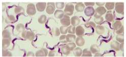 Trypanosoma in blood smear