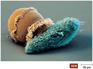 SEM of ciliate protozoan