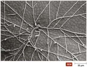 SEM of fungal hyphae