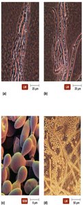 Fungal morphology: hyphae and yeast forms