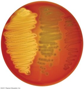 Blood agar as a differential medium