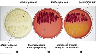 MacConkey agar as selective and differential medium