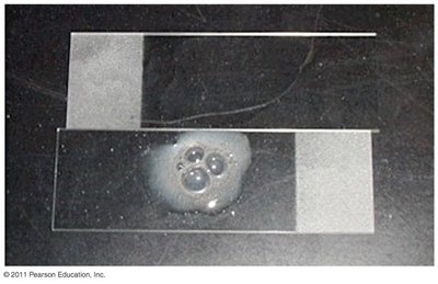 Catalase test with bubbles on a slide