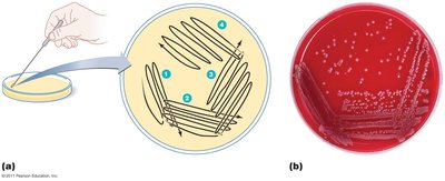 Streak plate method diagram and result