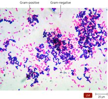 Gram-positive and Gram-negative bacteria under microscope